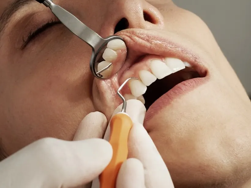 Control odontológico con espejo bucal